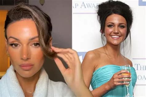 michelle keegan ears|Inside Michelle Keegans dramatic face transformation as she。